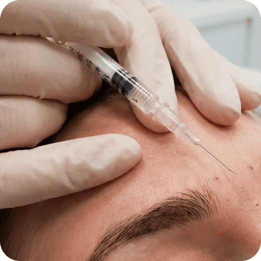 ボトックス (アラガン製) 2カ所